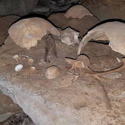 Human bones
