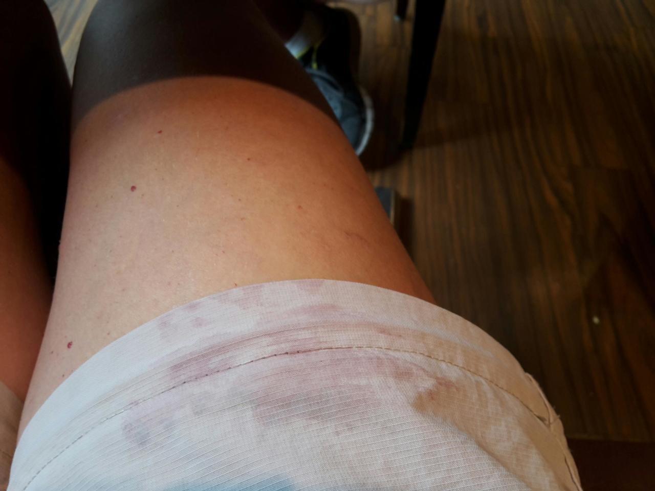 Marmelade an Hosenbein