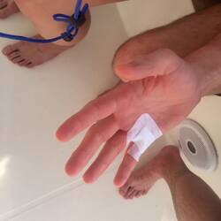 😟 perfekt verarztet😊