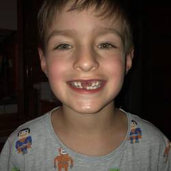 Unser Schlüsselwort dieser Tage: Schutzzaun