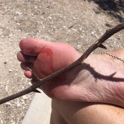 Ouch!