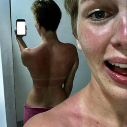 Yes, I do have sunscreen. Yes, I do use it. Yes, I'm still sunburnt...