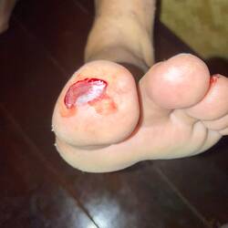 My (Battered) Left Foot