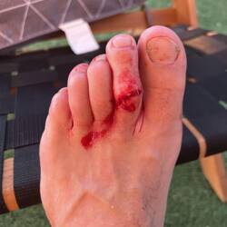 Andy sliced hos toe on a fishing knife. Quick trip to local hospital, where it got bandaged up 🤭