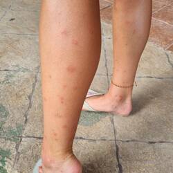 Jetzt hat es mich auch erwischt