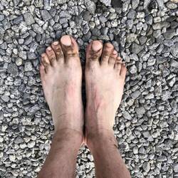 Mes pieds après la rando / my foots after the hike