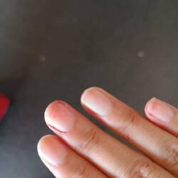 Back to reality. Hurt my finger, bloody nail while lugging my luggage from the packed conveyor belt.