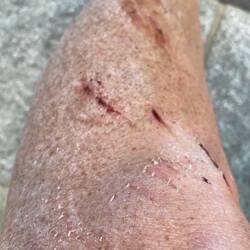 War wounds from my second tumble in the gravel