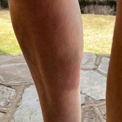 Ganz ohne Blessuren komme ich auch nicht davon