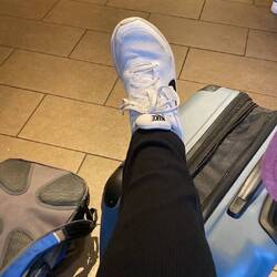 Burns ankle. After feeling smug we'd avoided Starbucks, it ended up being a lifesaver for its WiFi