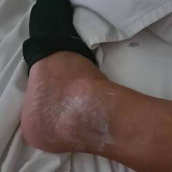 Das Übel nimmt seinen Lauf