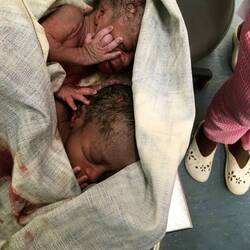 Vpk brengt jongetjes (elk 1,5 kg) naar neonatologie.