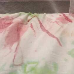 Beweismaterial des einen immer Weghüpfenden...