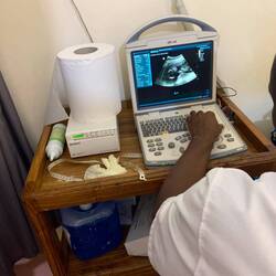 Baby in maand 4, 16 weken echo