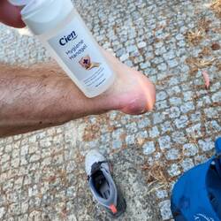 AAAAAAAAA hat des gebrannt auf der aufgeschnittenen Blase