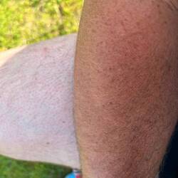 Leichte Streifenbildung🤣