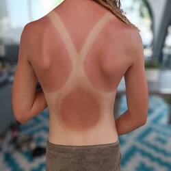 Wir dachten wir wären schon etwas braun gebrannt