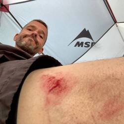 Autsch! Im Moment tut die Stelle jedoch noch nicht wirklich weh. 👍🏻