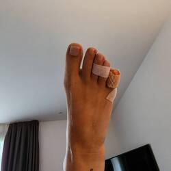 Toes taped up so the little one doesn't hurt. And there's the tattoo that matches the graffiti.