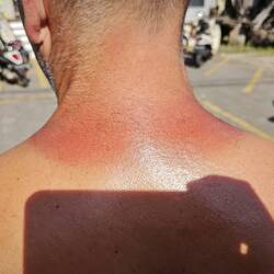 Scooter driver neck
