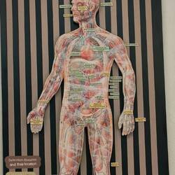 Not only did the professions become gaoled if resisted, experiments were performed also