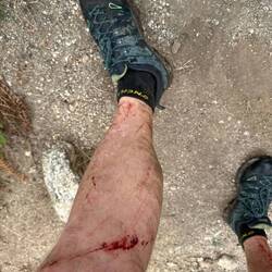 Weg nicht gefunden 🤷‍♂️....leichte Blessuren 😉