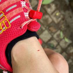 The blood came later... now I know how to remove a leech