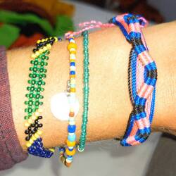 Ive got some armband thing going on