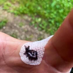 Aron muss verarztet werden 🏥