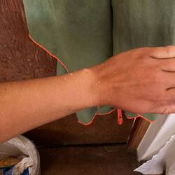 Wenn man nur mit Wetsuit in der Sonne ist