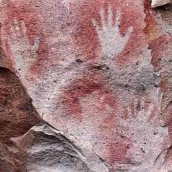 Mittig unten die Arthritis Hand