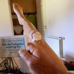 Meanwhile im "Krankenzimmer" - man beachte die geschwollenen Finger!