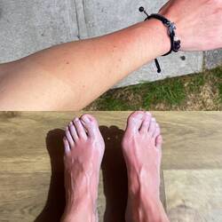 Irgendwann hat einen die Sonne trotz Crems 🤪