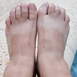 Η διαφορά στο χρώμα εντός 4 ωρών με πέδιλο στην ζούγκλα