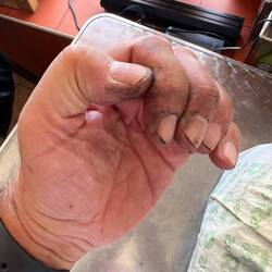 Meine Finger beim Mittagessen nach der Reparatur der Kette