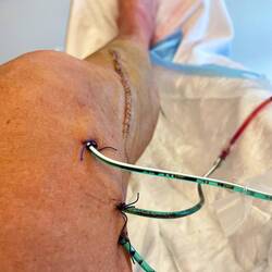 Serious doping starting 5 months ahead