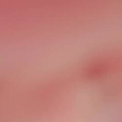 1 Seidl € 18,- 😢