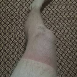 i'm writing this a month later and that line is still there