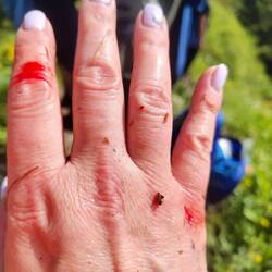 Der Berg fordert seinen Tribut