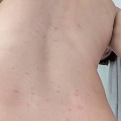 auch der Rücken ist nicht verschont geblieben