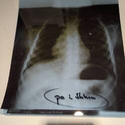 Seine Granatensplitter wurde in 🇩🇪 entfernt. Unten steht klein die Klinik