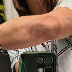 This was blown up like a balloon, getting better