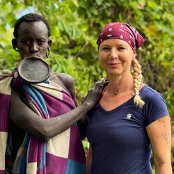 Diese Frau hat den größten Lippenteller der Suri 😳