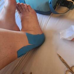 Right foot all taped up to help the plantar fascia