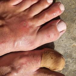 Und die Blessuren gehören leider dazu...