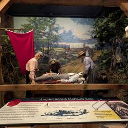 Amputations saved hundreds of lives