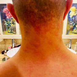 Und das nur für den Preis von 25 Mückenstichen nur am Hinterkopf 😁