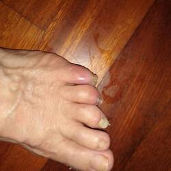 Now that we're almost done, I'm willing to show my feet. They are a mess.