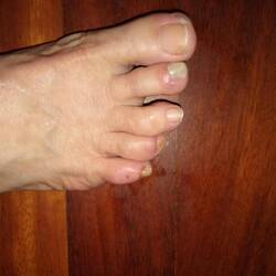 First toenail fell off this afternoon. At least two more to follow.