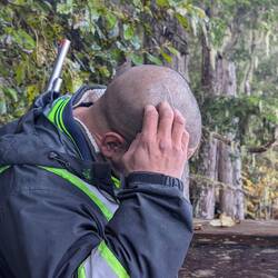 Cody showing us his scars.